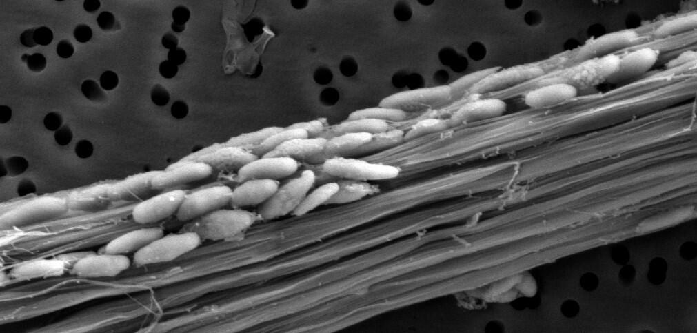 Feather-eating bacteria covering feather fibers