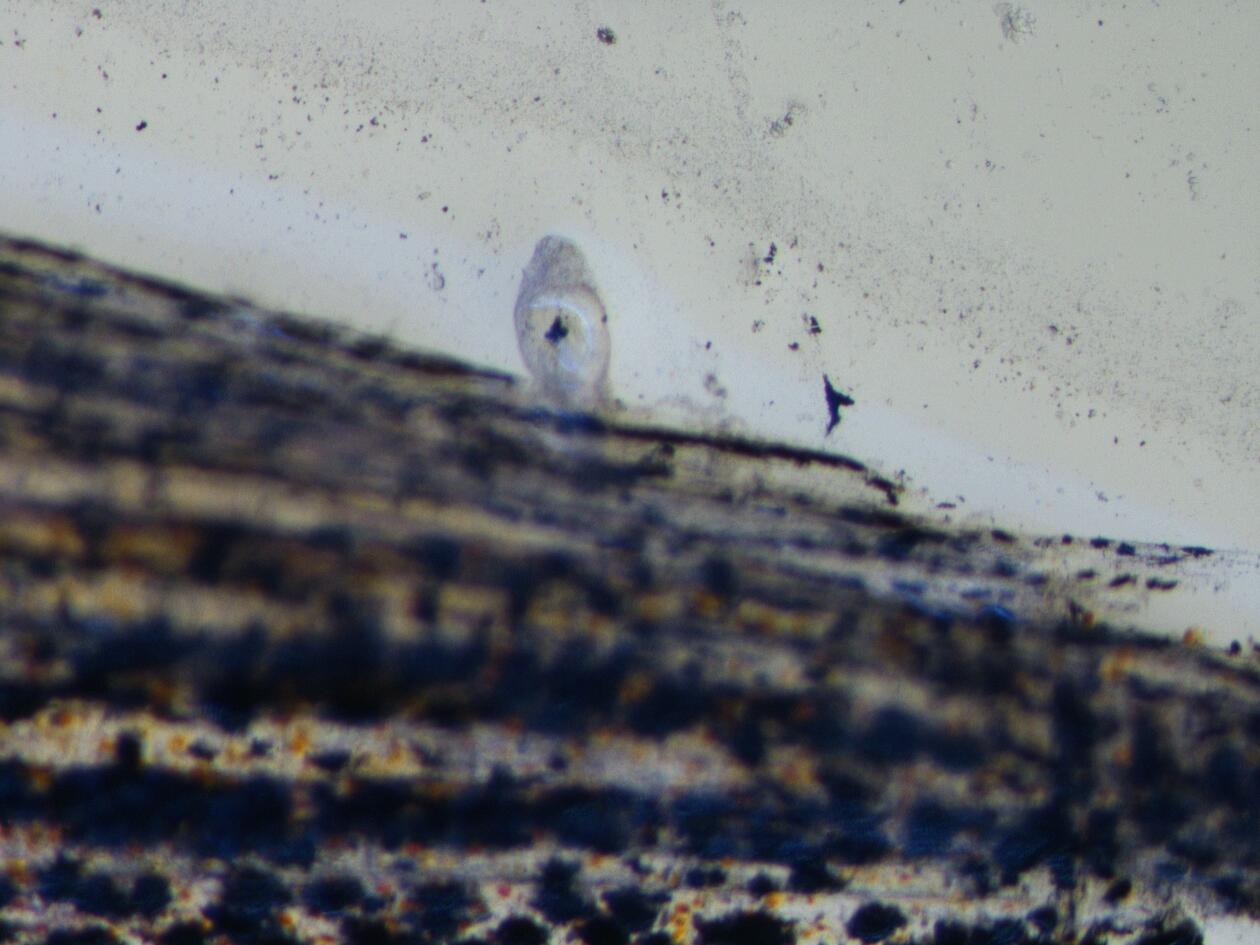 Microscope image of a parasite attached to fin of a fish