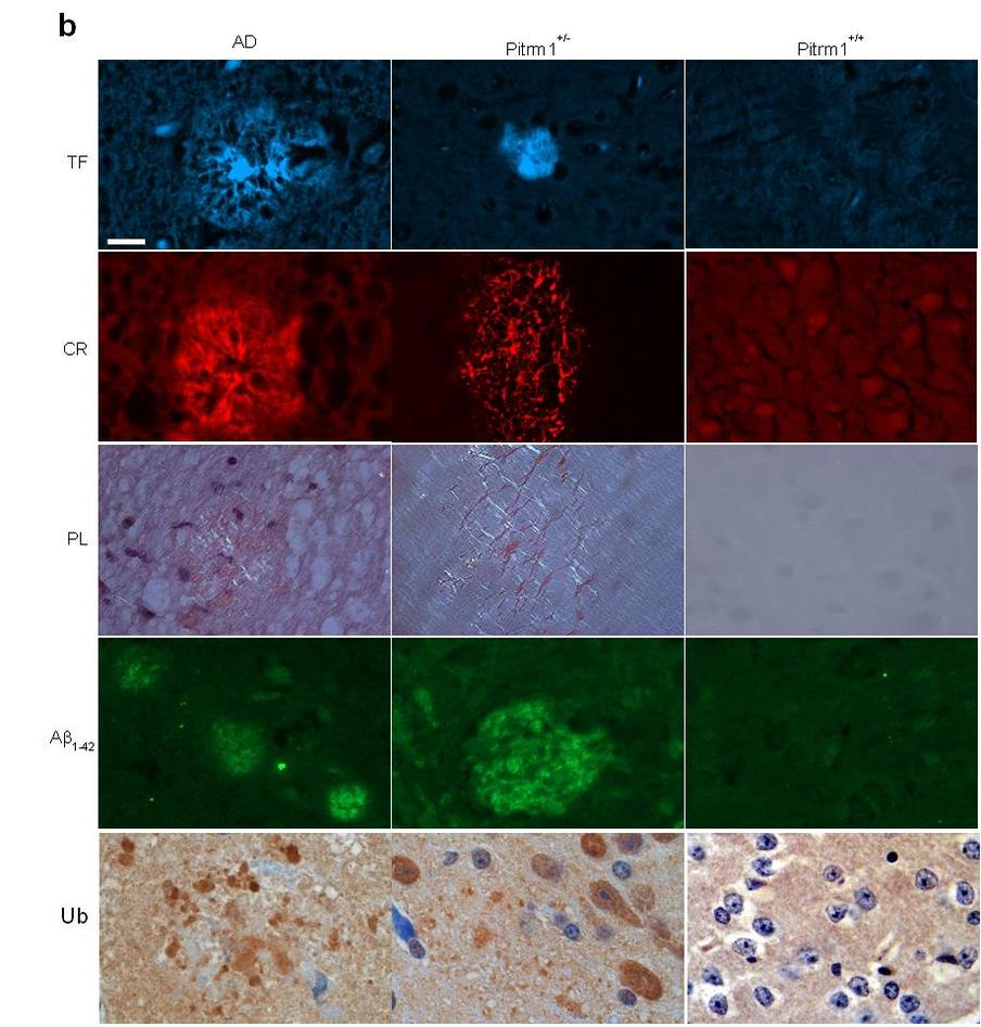 Morphological analysis of brain sections