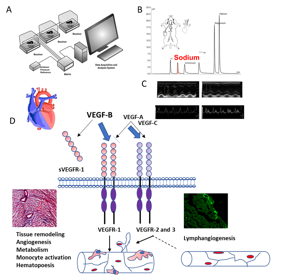 VEGF-B overexpressing heart is sensitized to develop heart failure in DOCA-salt hypertensive rats 