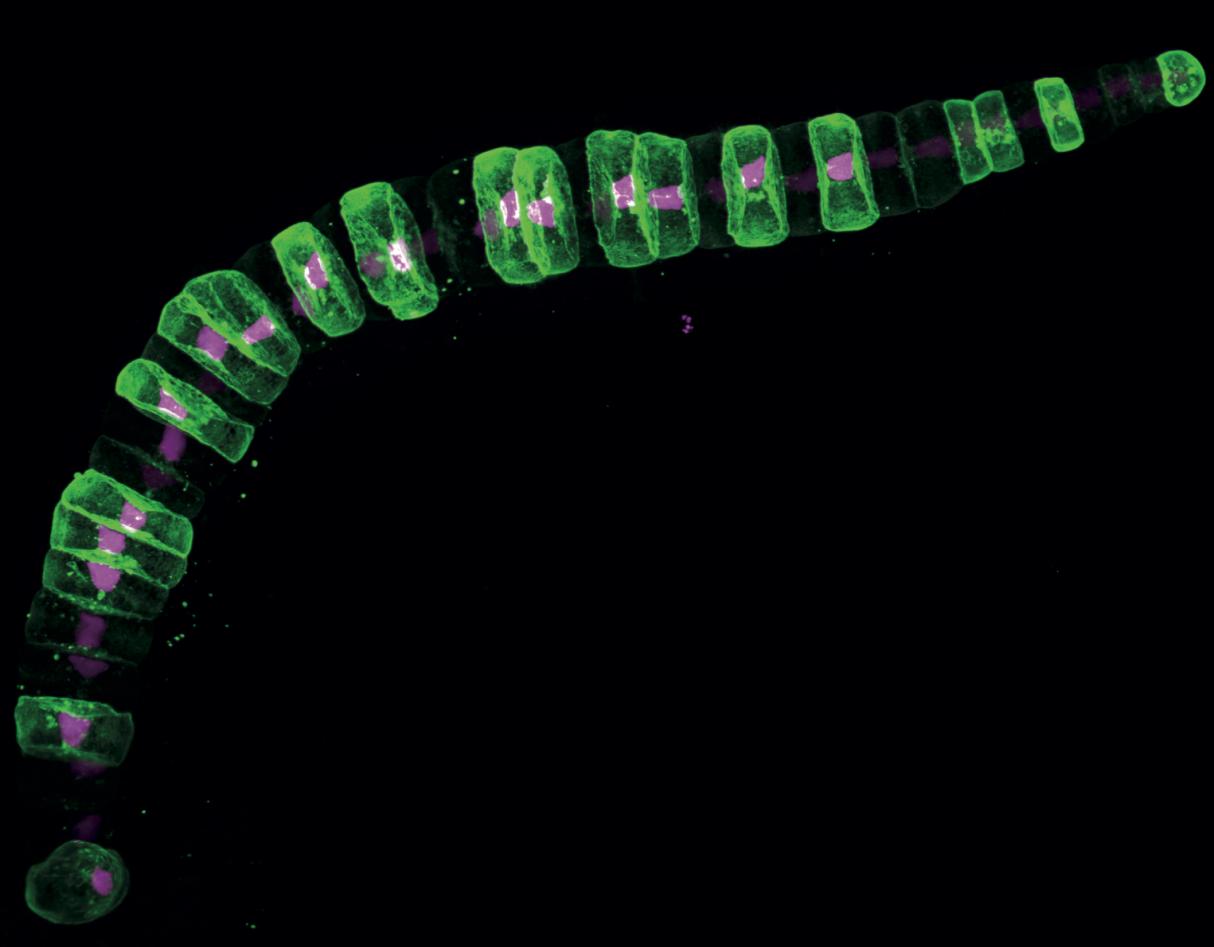 Notochord 