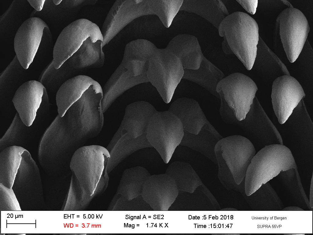 rachidian_teeth_of_radula.jpg