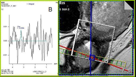 Spectroscopy image, of graphic image and graph.