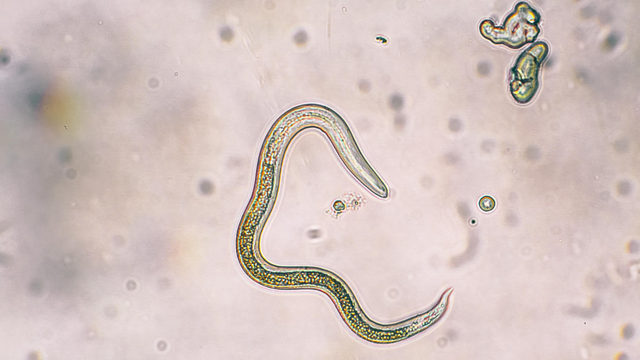 parasitic worms images
