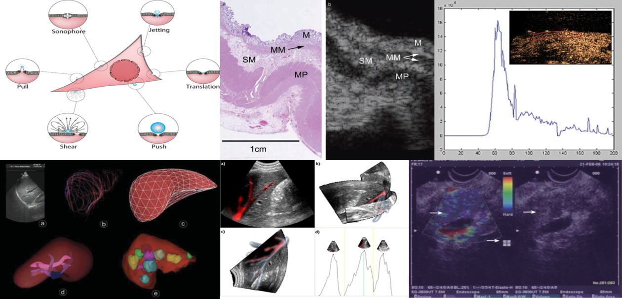 Various images of applies ultrasound modalities