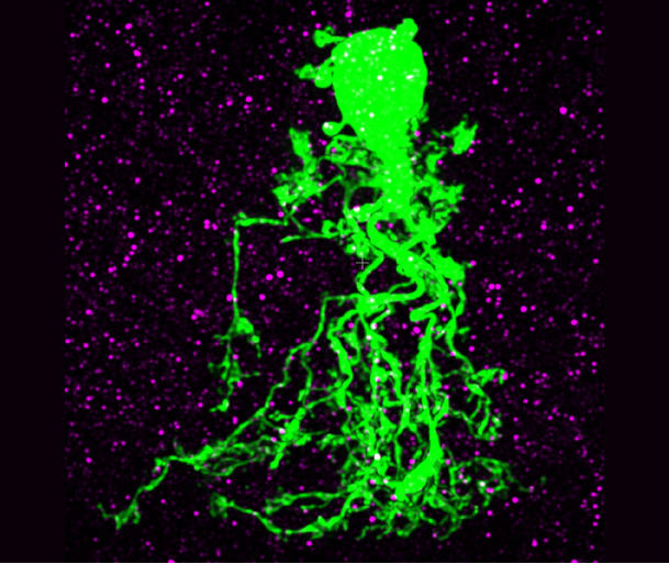 Mikroskopisk bilde av en nervecelle i netthinnen