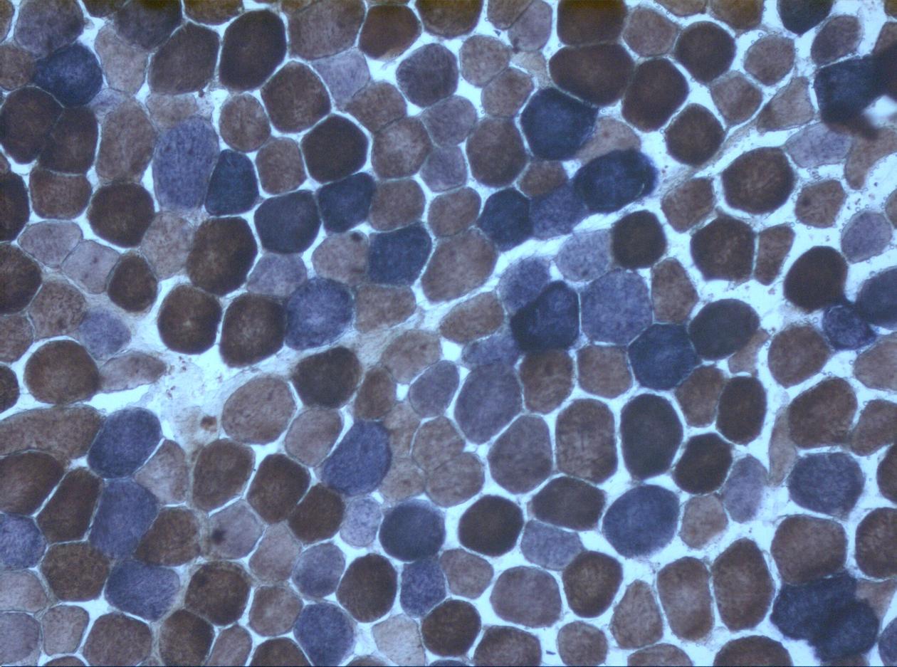 Double staining of skeletal muscle cryosection for cytochrome oxidase and...