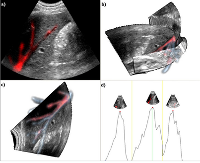 Visualization for ultrasonography