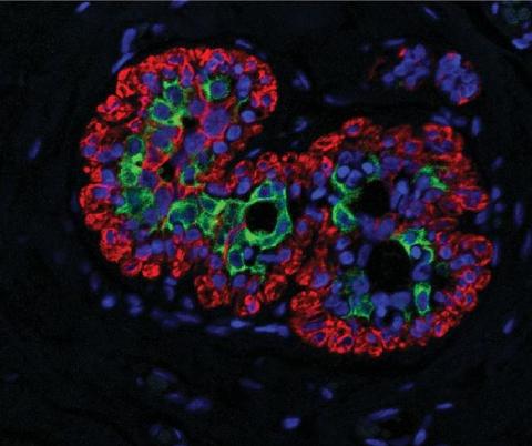 Light microscopic image of breast tissue labelles with fluorescent dyes