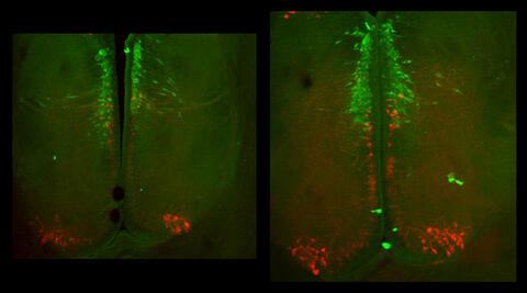 These two immunohistochemistry images show salmon brains. The brightly...