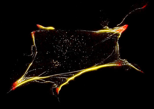 The image shows a stained cell with adhesion patches in red and actin cytoskeleton in yellow/white