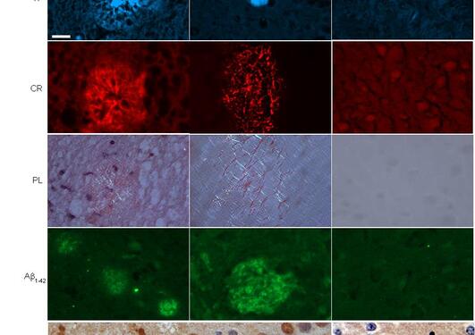 Morphological analysis of brain sections