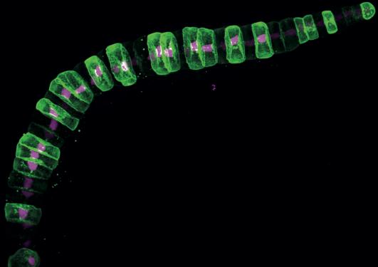 Notochord 