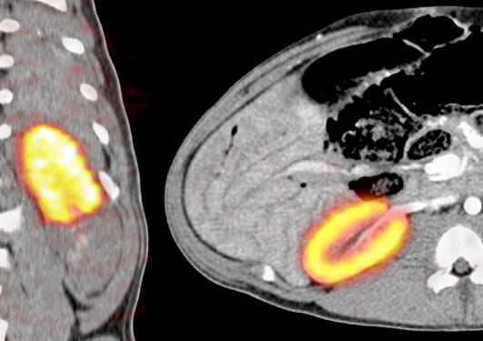 PET-CT som viser glomerulusfiltrasjon i en anestesert gris etter avstengning...