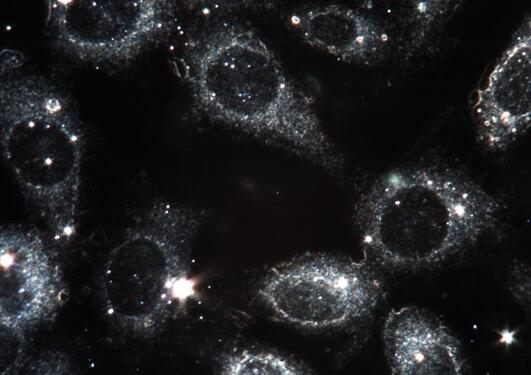Nanopartikler og celler